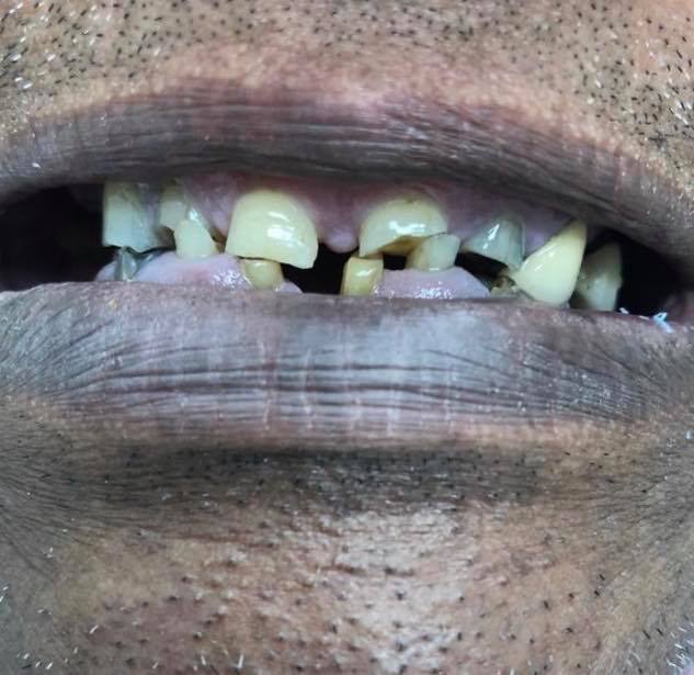 Implant Smile Gallery - Manotick